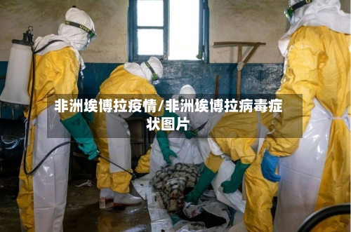 非洲埃博拉疫情/非洲埃博拉病毒症状图片